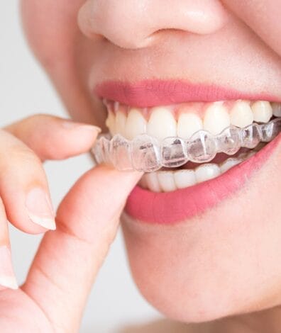 free lifetime retainers