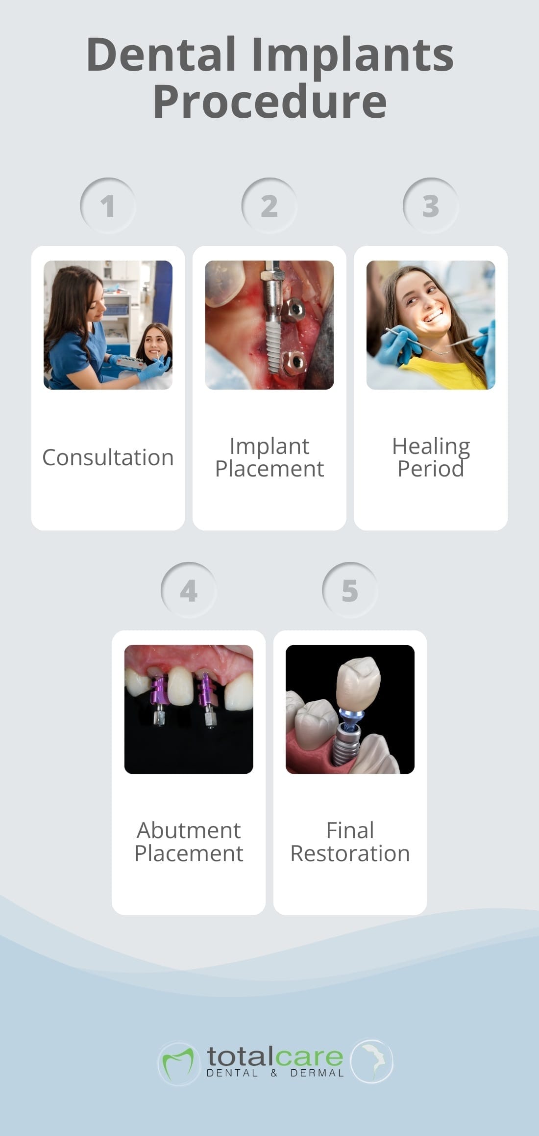 procedure of dental implants procedure of dental implants