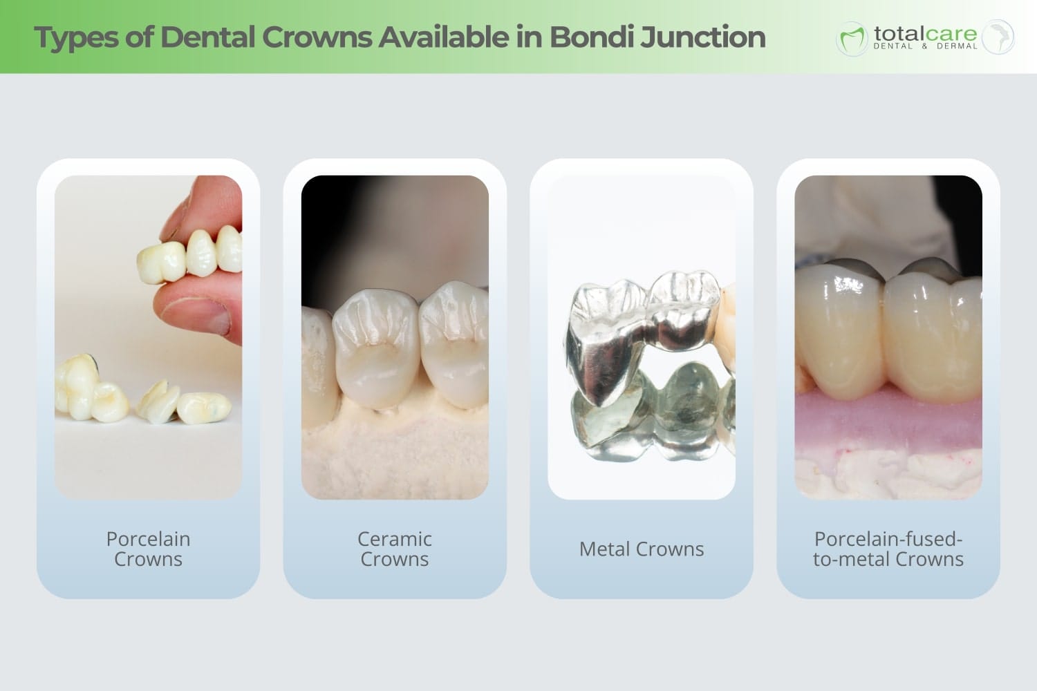types of dental crowns available in bondi junction types of dental crowns available in bondi junction